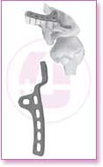 Spine Stainless Steel, Spine Titan, Product Instruments, Intervertebral Spacers, Bone Leaver, Elevator, Screws, Anchors, Arthroscopy, LCP Instruments Set, LCP Plates, Trauma Nail System, MND Interlocking Nailing System, Trauma Plates, Trauma, Trauma Screws