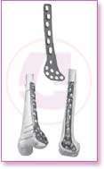 Spine Stainless Steel, Spine Titan, Product Instruments, Intervertebral Spacers, Bone Leaver, Elevator, Screws, Anchors, Arthroscopy, LCP Instruments Set, LCP Plates, Trauma Nail System, MND Interlocking Nailing System, Trauma Plates, Trauma, Trauma Screws