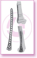 Spine Stainless Steel, Spine Titan, Product Instruments, Intervertebral Spacers, Bone Leaver, Elevator, Screws, Anchors, Arthroscopy, LCP Instruments Set, LCP Plates, Trauma Nail System, MND Interlocking Nailing System, Trauma Plates, Trauma, Trauma Screws