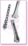 Spine Stainless Steel, Spine Titan, Product Instruments, Intervertebral Spacers, Bone Leaver, Elevator, Screws, Anchors, Arthroscopy, LCP Instruments Set, LCP Plates, Trauma Nail System, MND Interlocking Nailing System, Trauma Plates, Trauma, Trauma Screws