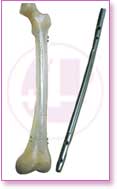 Spine Stainless Steel, Spine Titan, Product Instruments, Intervertebral Spacers, Bone Leaver, Elevator, Screws, Anchors, Arthroscopy, LCP Instruments Set, LCP Plates, Trauma Nail System, MND Interlocking Nailing System, Trauma Plates, Trauma, Trauma Screws