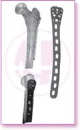 Spine Stainless Steel, Spine Titan, Product Instruments, Intervertebral Spacers, Bone Leaver, Elevator, Screws, Anchors, Arthroscopy, LCP Instruments Set, LCP Plates, Trauma Nail System, MND Interlocking Nailing System, Trauma Plates, Trauma, Trauma Screws