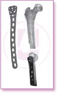 Spine Stainless Steel, Spine Titan, Product Instruments, Intervertebral Spacers, Bone Leaver, Elevator, Screws, Anchors, Arthroscopy, LCP Instruments Set, LCP Plates, Trauma Nail System, MND Interlocking Nailing System, Trauma Plates, Trauma, Trauma Screws